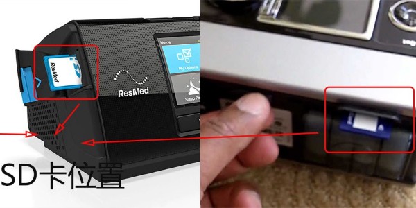 為什么說家用呼吸機售后很重要