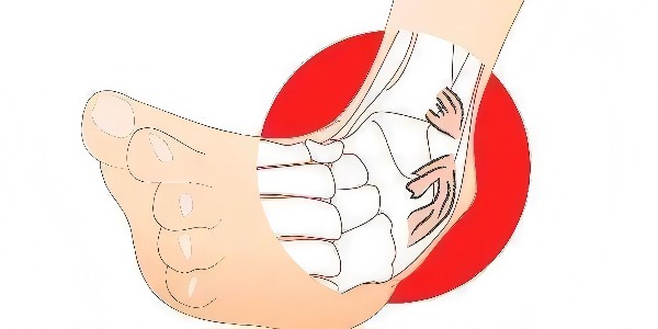 踝關節(jié)扭傷后的最佳應對指南：簡單四步，助力快速康復！