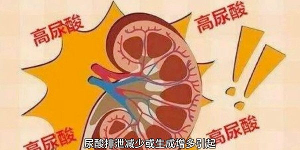 突然痛風(fēng)？別再只怪啤酒和燒烤！真正的“尿酸元兇”遠(yuǎn)比你想的多！